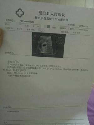 怎么确定是不是怀孕了