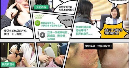 上网能引起痘痘