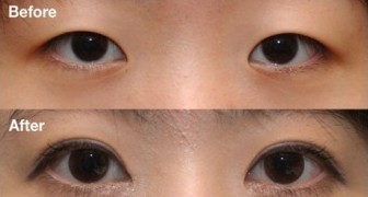 割双眼皮谁家好
