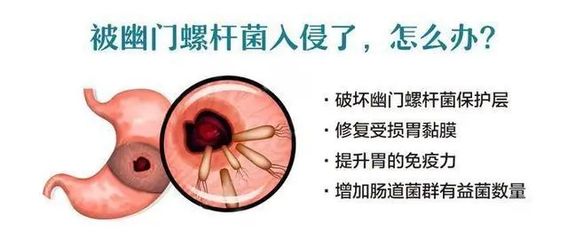 螺杆菌怎么治疗