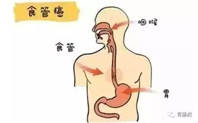 偶尔食道疼是怎么回事