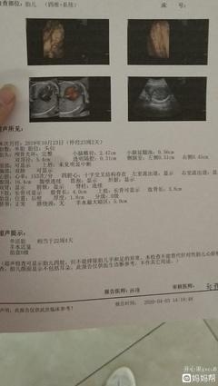 怎么测试男女宝宝最准