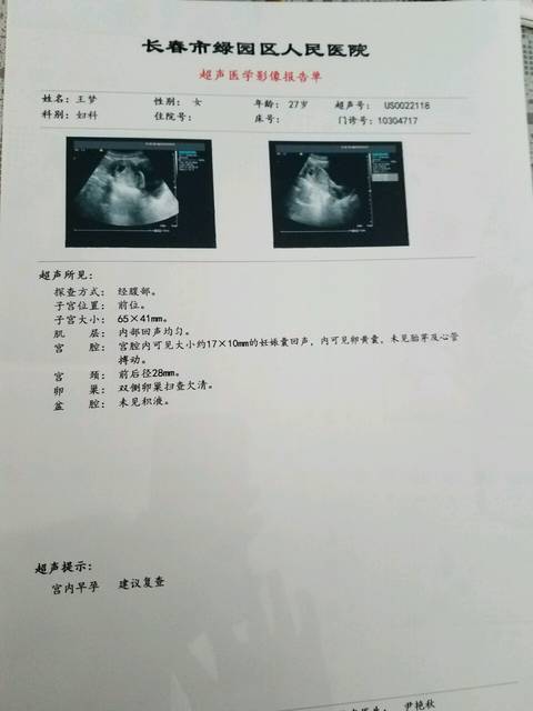 怀孕两个月流血了怎么办
