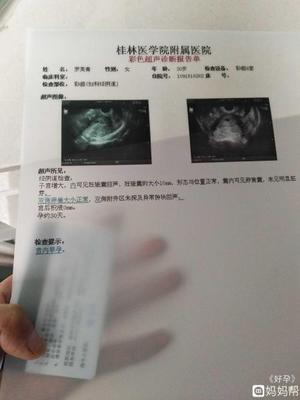 怀孕几天有孕囊