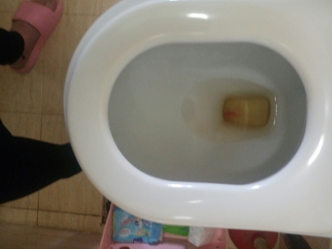 小便出血是怎么回事男