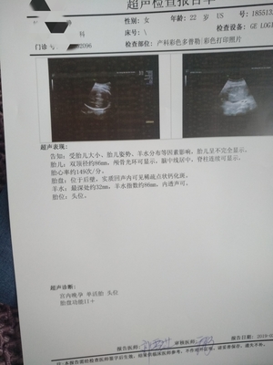 胎儿畸形能检查出来吗
