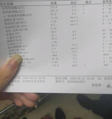 怀孕转氨酶高是怎么回事