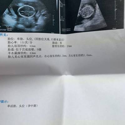 18周胎儿真实图