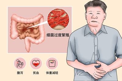 低蛋白血症怎么治疗