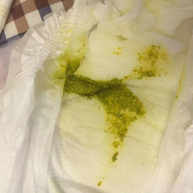 宝宝大便绿色是怎么回事