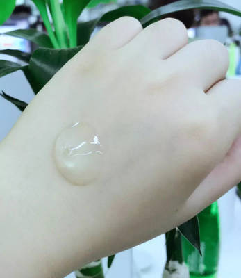 芦荟胶摸痘痘上