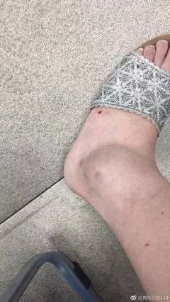 脚发软是怎么回事