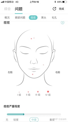 额头右边疼是怎么回事