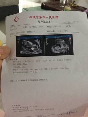 胎盘后壁几个月显怀