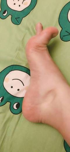 脚脖肿是怎么回事