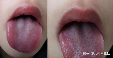 胃口高是怎么回事
