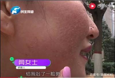 郑州 痘痘