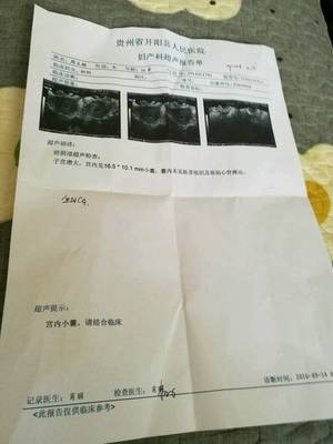 检查怀孕去什么医院