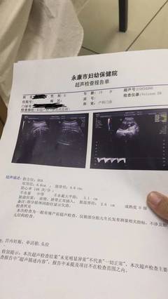 怀孕六个月查什么项目