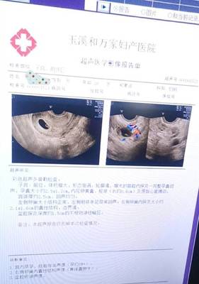 怀孕两天会恶心吗