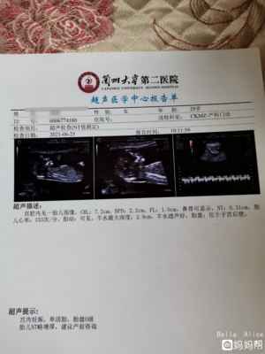 怀孕多少周可以做nt