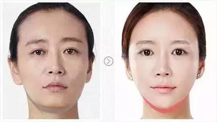 脸部松弛下垂怎么紧致
