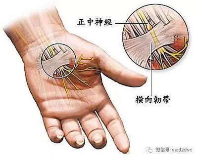 手麻痛是怎么回事