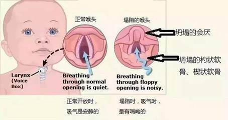 喉咙响是怎么回事