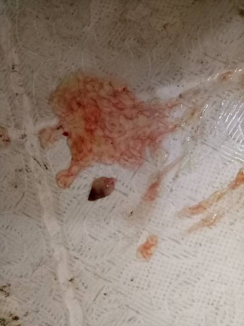 做梦梦到出血