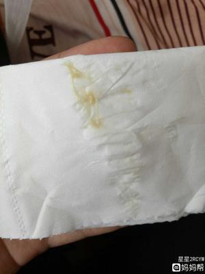 白带有点咖啡色是怎么回事