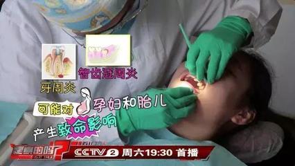 孕妇智齿