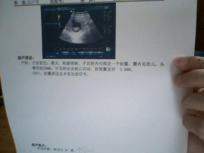 9周胎儿