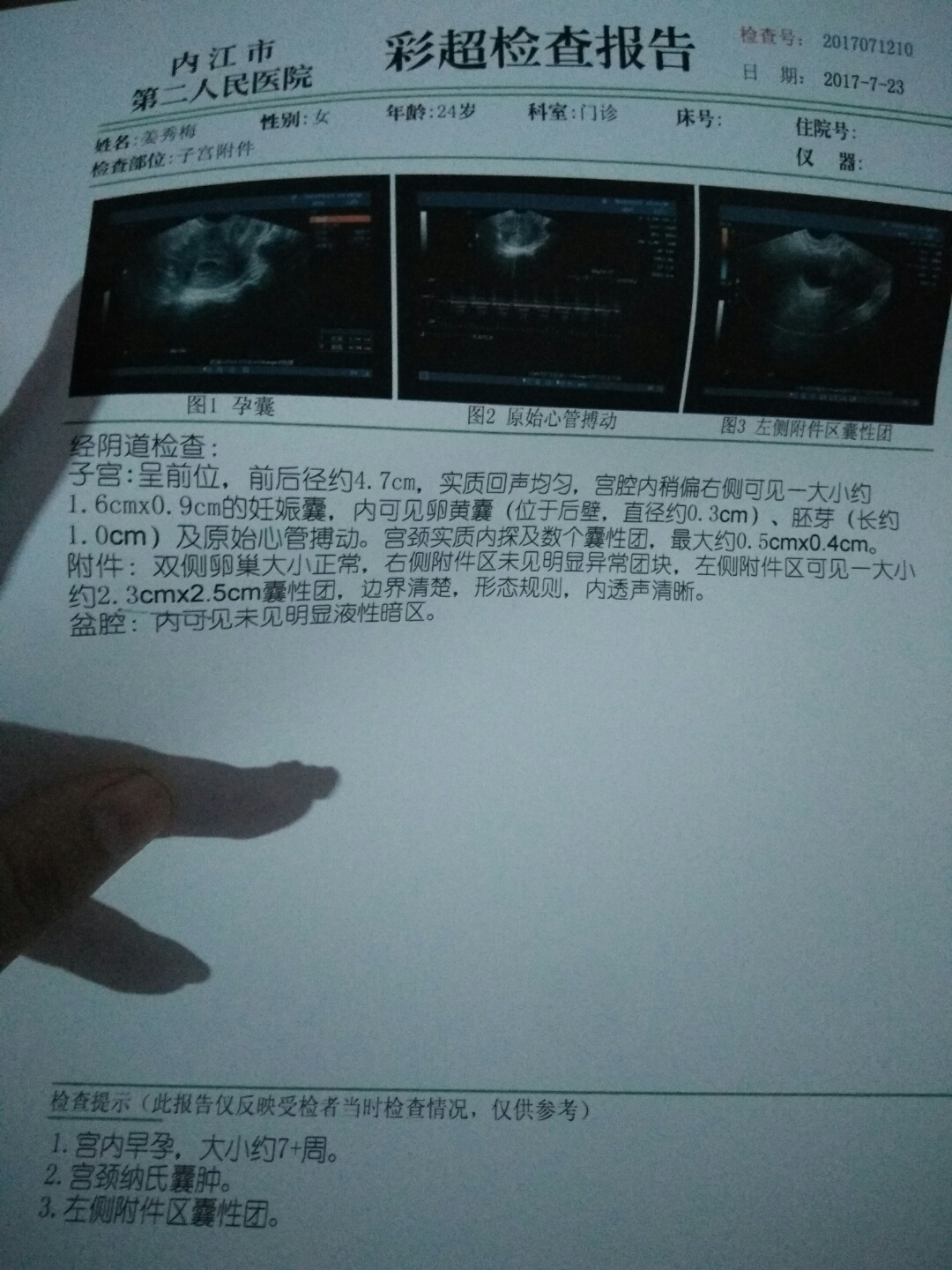 刚怀孕流血