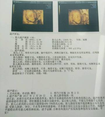 怀孕30多天有什么反应