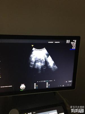 33周宝宝4斤正常吗
