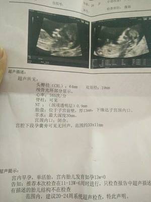 孕三十三周是几个月