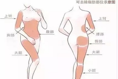 抽脂的危害