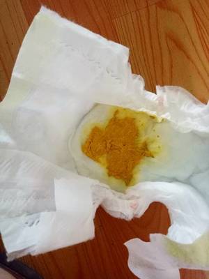 宝宝的便便有酸臭味