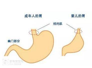 新生儿胃图片