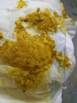 宝宝拉的粑粑黏糊糊的