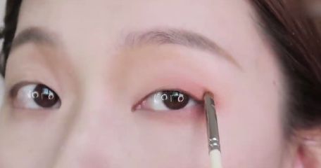 迅速变双眼皮