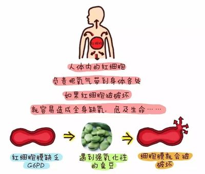 蚕豆病溶血怎么治疗