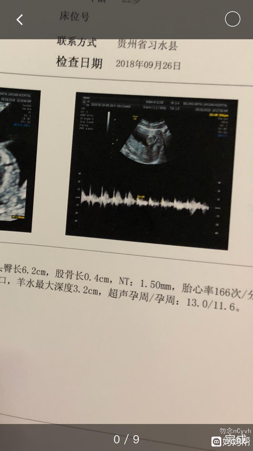 怀孕初期心率多少正常
