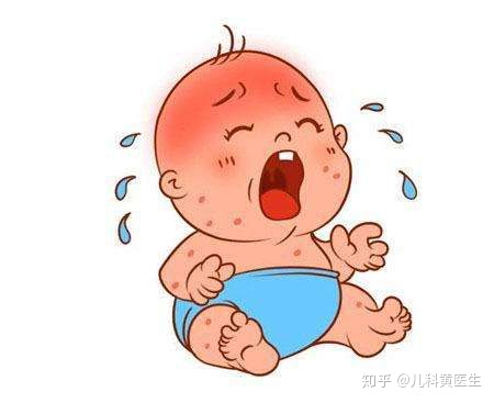 六个月宝宝过敏怎么办