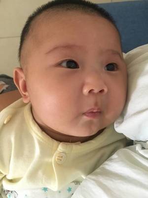 宝宝上眼皮红肿怎么办