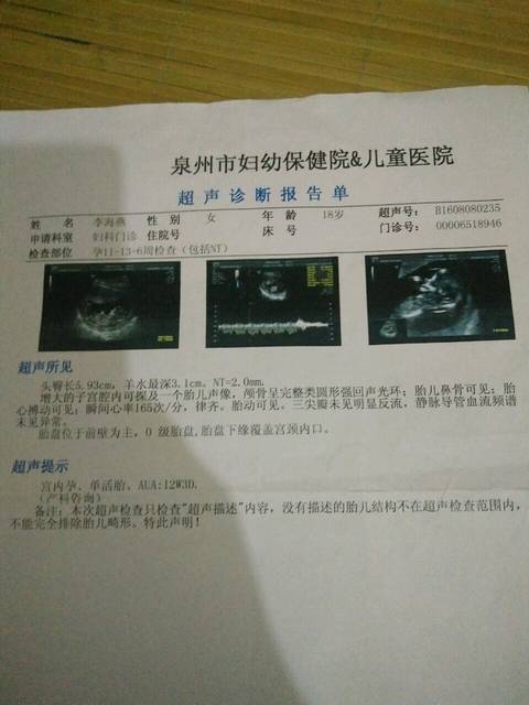 怀孕三个月怎么看男女