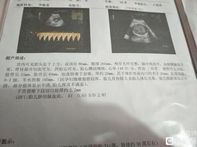 孕32周羊水多少正常
