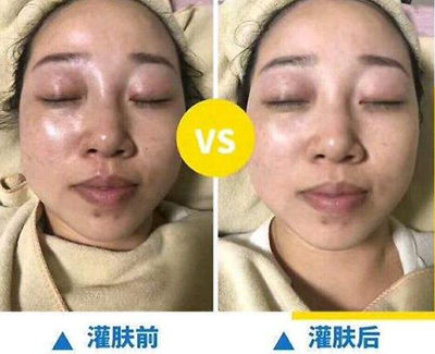 美容水疗怎么做