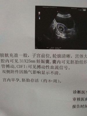 胎儿一般多少天有胎心