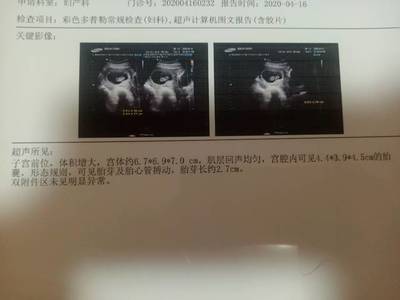 怀孕初期少量出血正常吗
